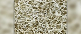 Best supplements for bones