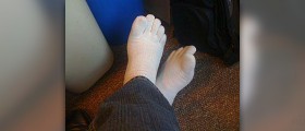 Big toe joint pain