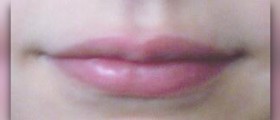 Bitter taste in mouth causes