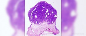Bladder control problem