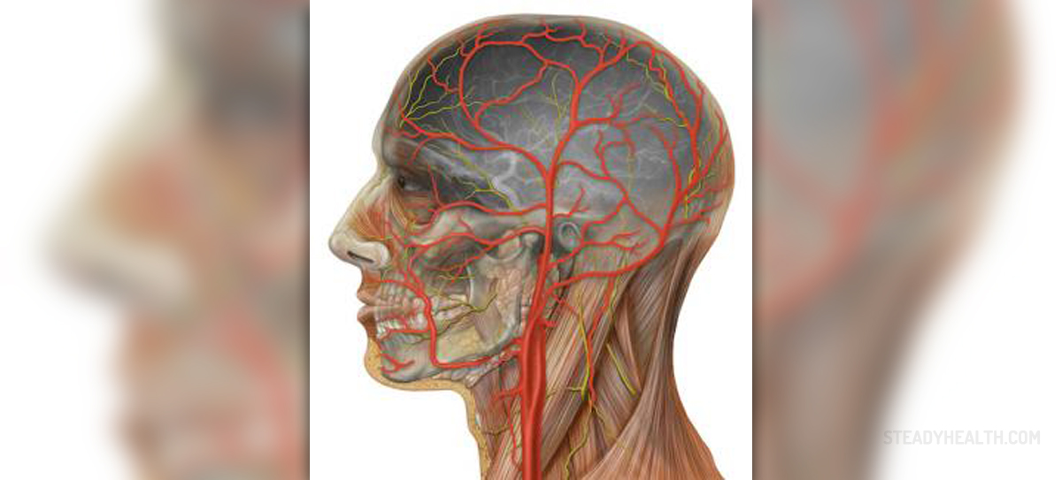 Blocked arteries in neck | General center | SteadyHealth.com