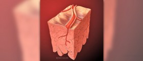 Blocked arteries: symptoms and treatment