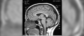 Blood clot in the brain