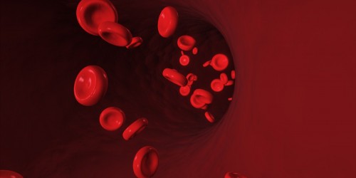 Thrombus Clots and You: Taking Preventive Measures Against Deep Vein Thrombosis