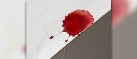 How long does an implantation bleeding last?