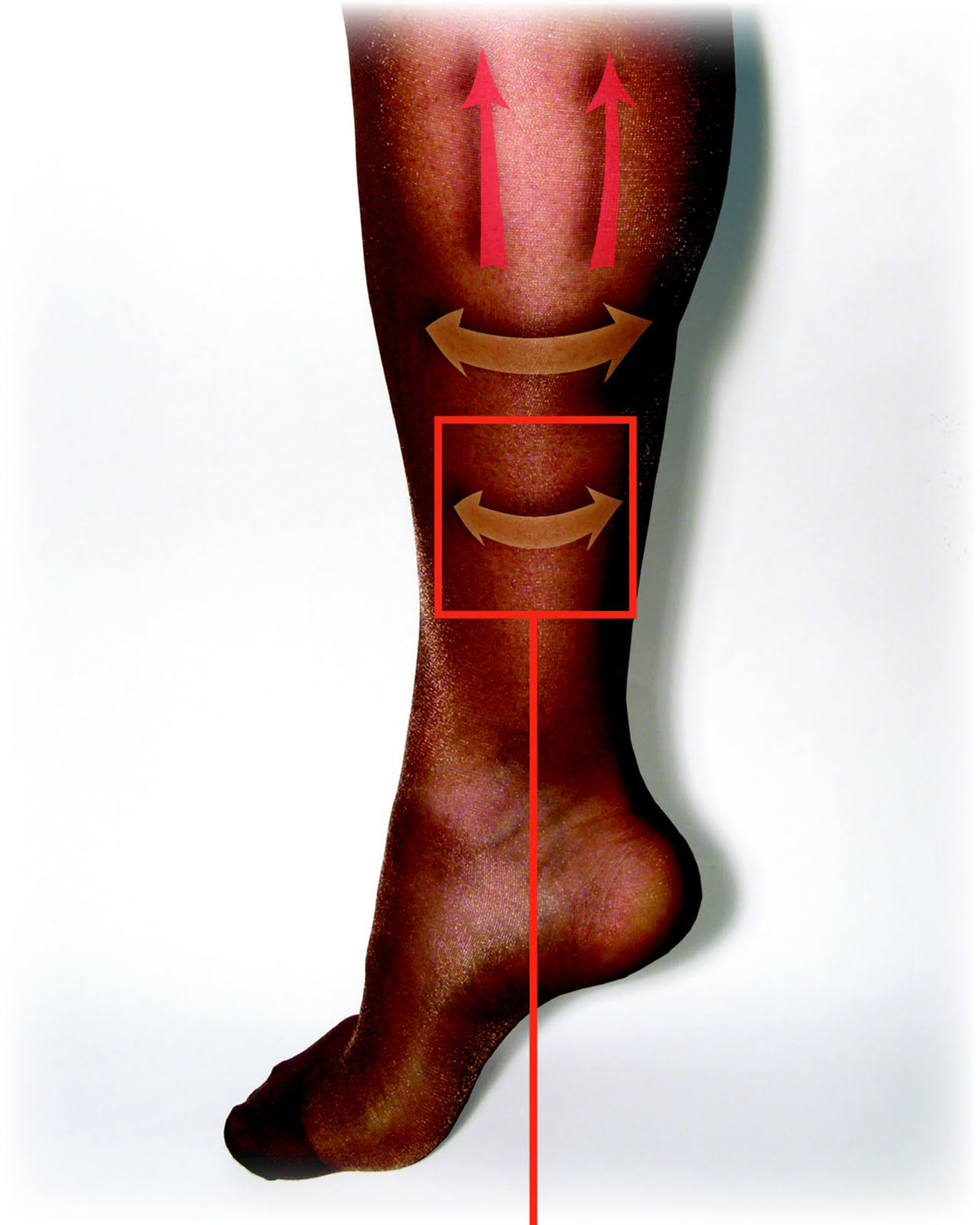 What Causes Low Blood Flow In Legs