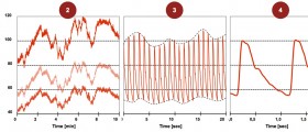 Mother's high blood pressure in pregnancy leads to lower IQ?