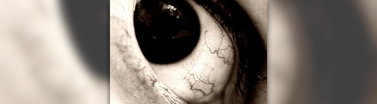 burst blood vessel in eye causes