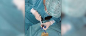 Bone marrow cancer