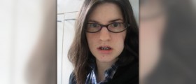 Braces for teeth