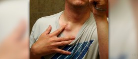Breast lumps in children