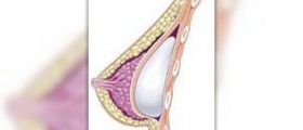Breast tenderness causes