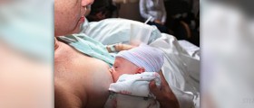 Breastfeeding thrush review