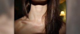 Broken clavicle
