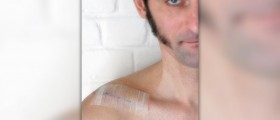 Broken collarbone treatment