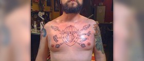 Broken rib treatment