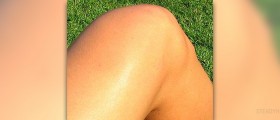 Burning pain in knee
