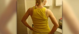 Burning upper back pain