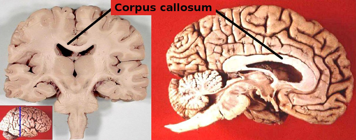 Corpus callosum function | General center | SteadyHealth.com