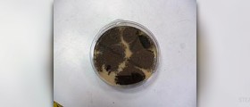 Can men get yeast infections