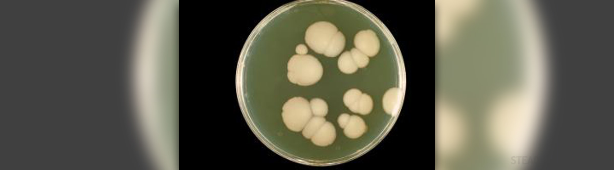 signs of yeast overgrowth