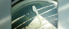 Candida yeast infection diet