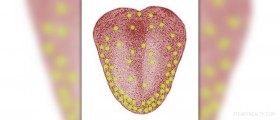 Canker sores on tongue