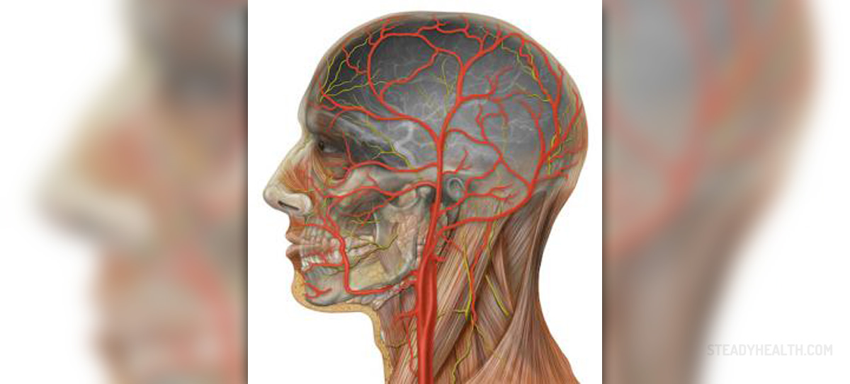 Carotid artery blockage surgery | General center | SteadyHealth.com