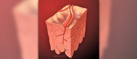 Carotid artery blockage treatment