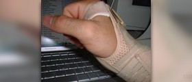 Carpal tunnel treatment