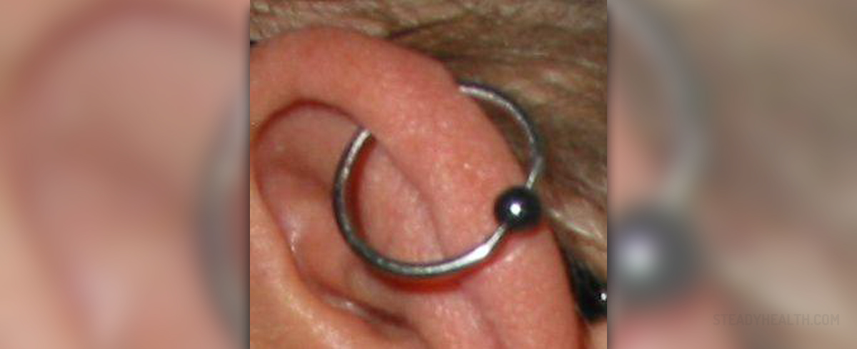 Cartilage Piercing Bump General Center Steadyhealth Com