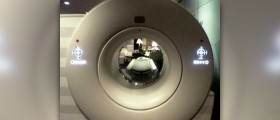 CAT scan vs MRI