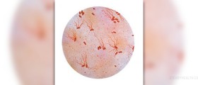 Causes and symptoms of salmonella infections