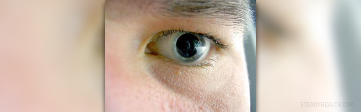 causes-of-dilated-pupils-general-center-steadyhealth