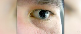 Causes of dilated pupils