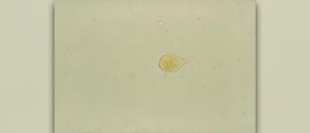 Causes of giardia