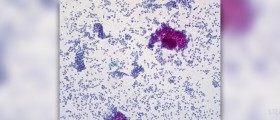 Causes of liver cancer
