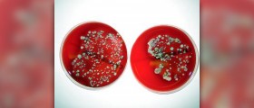 Causes of mrsa infection