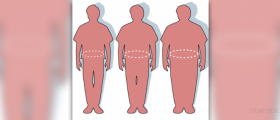 Causes of obesity in America