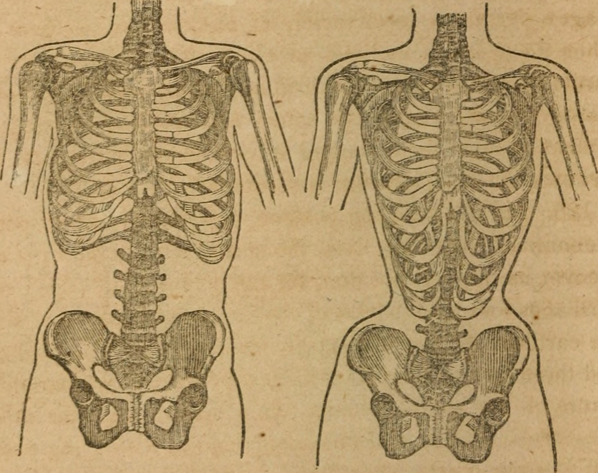 Causes of painful ribs | General center | SteadyHealth.com