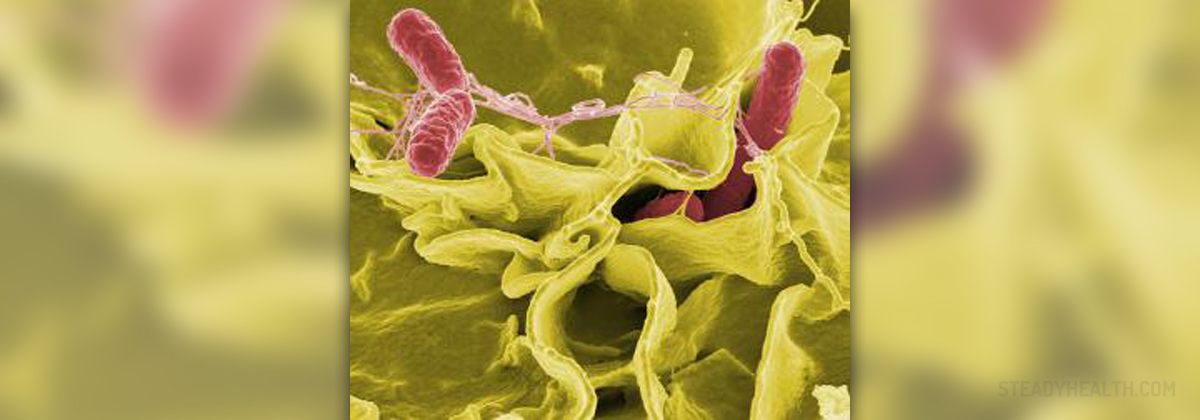 Causes of salmonella | General center | SteadyHealth.com