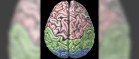 Cerebral hemorrhage causes