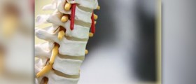 Cervical spine MRI