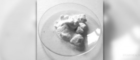 Chelation therapy for lead poisoning