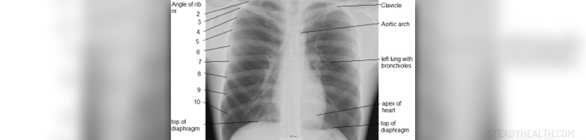 Right Side Of Chest Hurts When Breathing Out