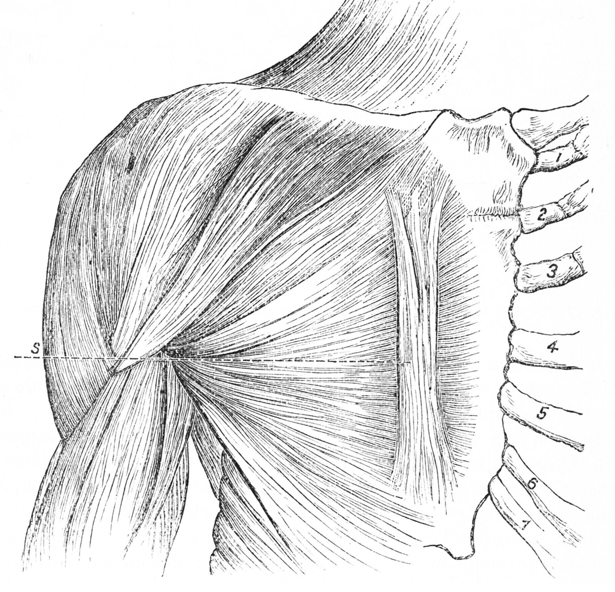 Muscle Pain Causing Chest Pain