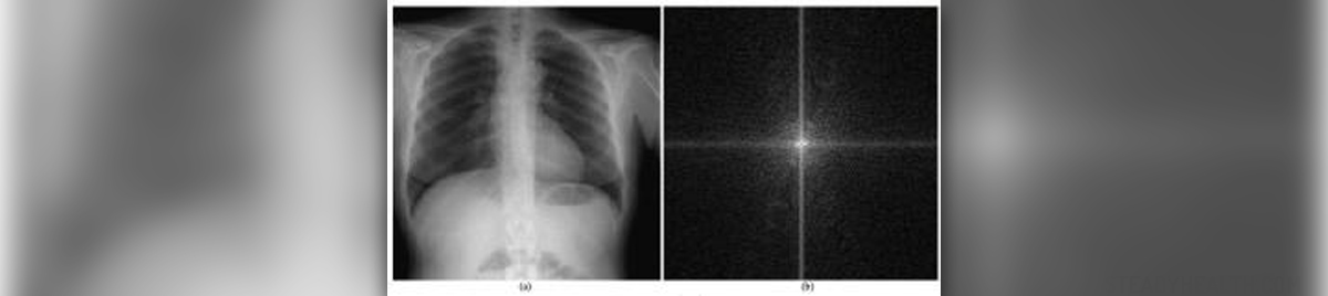 chest-pain-causes-general-center-steadyhealth