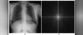 Chest pain causes
