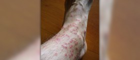 Chigger bites cure
