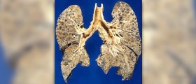 Children's guide for emphysema treatment